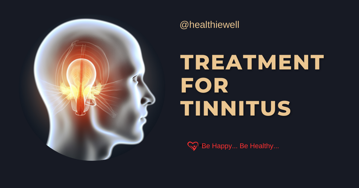 What is the most effective treatment for tinnitus in 2023?